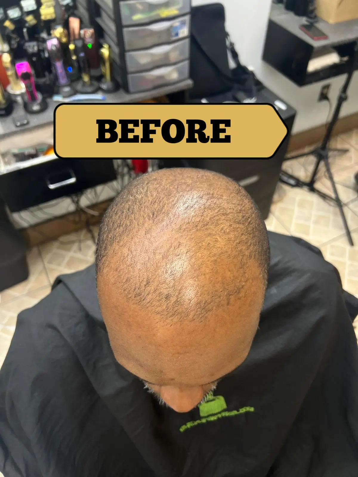 VIVI NATURAL HAIR GROWTH OIL